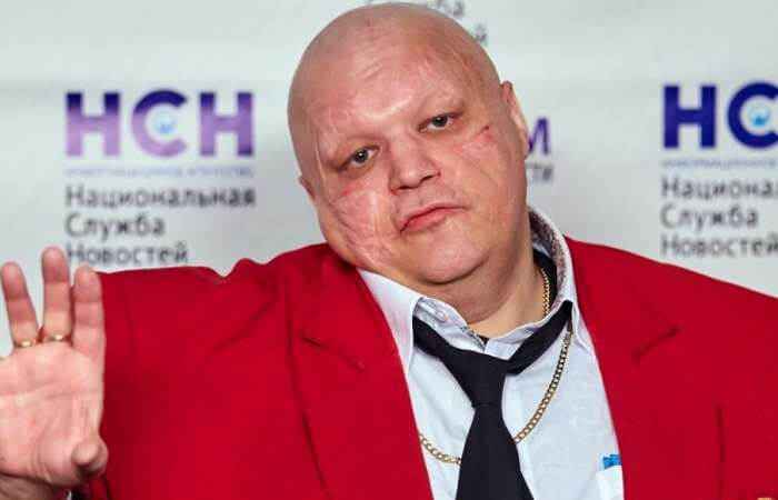 Барецкий рассказал правду о беременности жены Шнурова Барецкий рассказал правду о беременности жены Шнурова