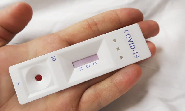 К регистрации еще 16 наименований белорусских тестов на COVID-19 готовятся в Минздраве К регистрации еще 16 наименований белорусских тестов на COVID-19 готовятся в Минздраве