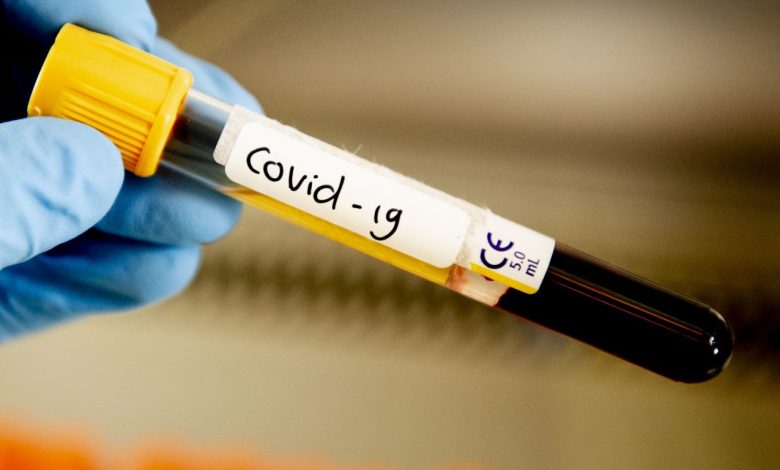 Минздрав рассказал, где можно сделать ПЦР-тесты на COVID-19 для выезда за границу Минздрав рассказал, где можно сделать ПЦР-тесты на COVID-19 для выезда за границу