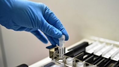 В России изобрели тест, выявляющий коронавирус в любом биоматериале