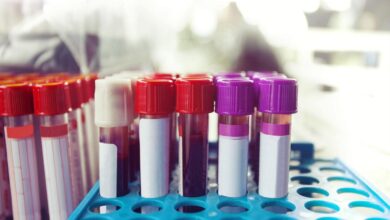 Новый анализ крови поможет диагностировать рак на ранней стадии 12