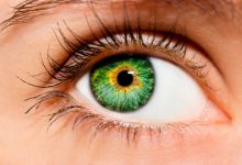 Разноцветные глаза могут стать причиной развития онкологии 29