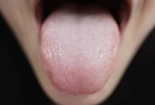 Привкус во рту может сигнализировать о серьезных заболеваниях 24