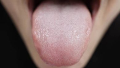 Привкус во рту может сигнализировать о серьезных заболеваниях 8