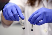 Иммунолог объяснил, почему вернулся метапневмовирус 17